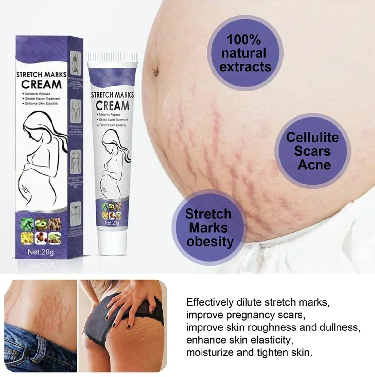Stretch Mark Vanishing Cream Effective treatment Remove Body Buttock Breast Marks Repair Maternity Loose Firming Skin body Care