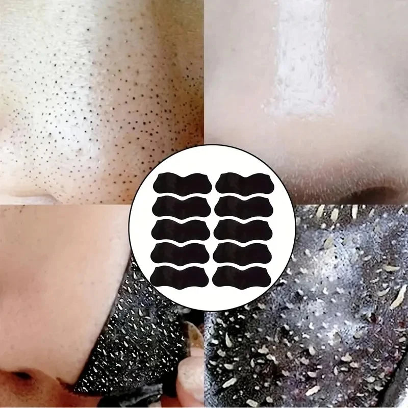 50/100PCS Bamboo Charcoal Nasal Strips Blackhead Remover Mask Acne Pimples Treatment Patch Shrink Pores Nose Stickers Skin Care
