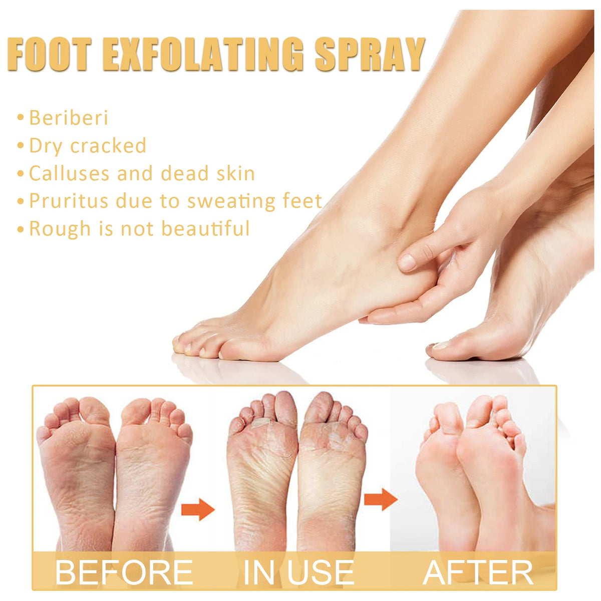 Ouhoe Foot Exfoliating Spray 72H Moisture Lock Callus Softener Anti Dry Crack Repair Odor Control Brightening Foot Care Liquid