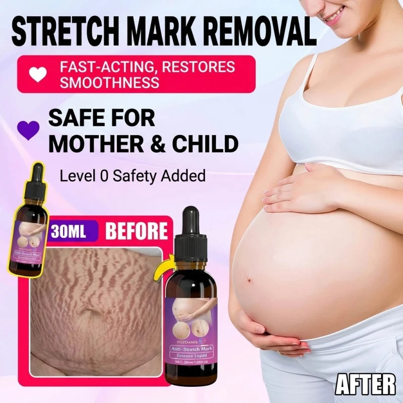 Intensive Stretch Mark Corrector Body Oil for Pregnancy & Post-Baby, C-Section Scar Fader & Anti-Sagging Firming Therapy