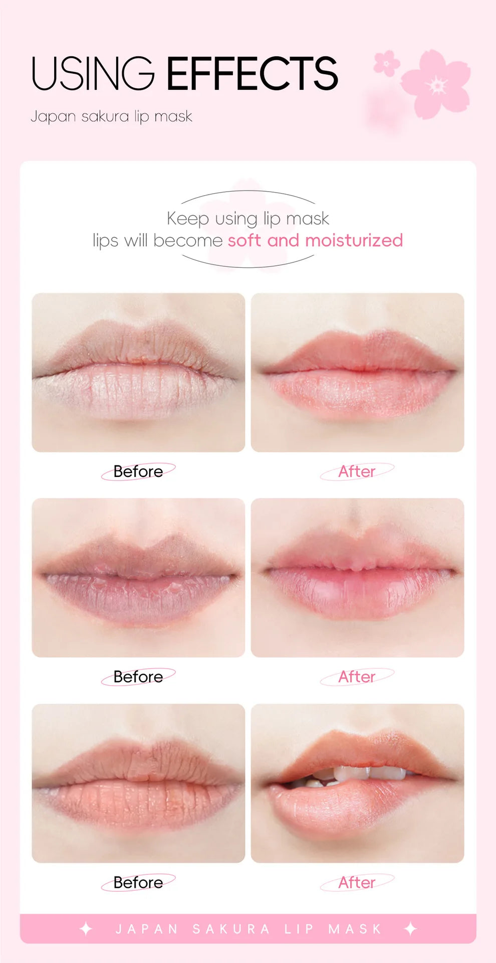 Japan Sakura Collagen Lip Mask Hydrating Plumping Treatment For Dry Lips Repair Gel Pads Night Care Essential