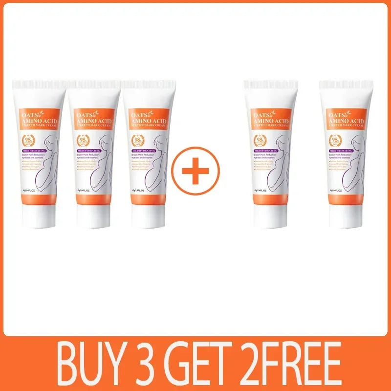 Powerful Stretch Marks Remover Pregnancy Cream Light Lines Removal Postpartum Obesity