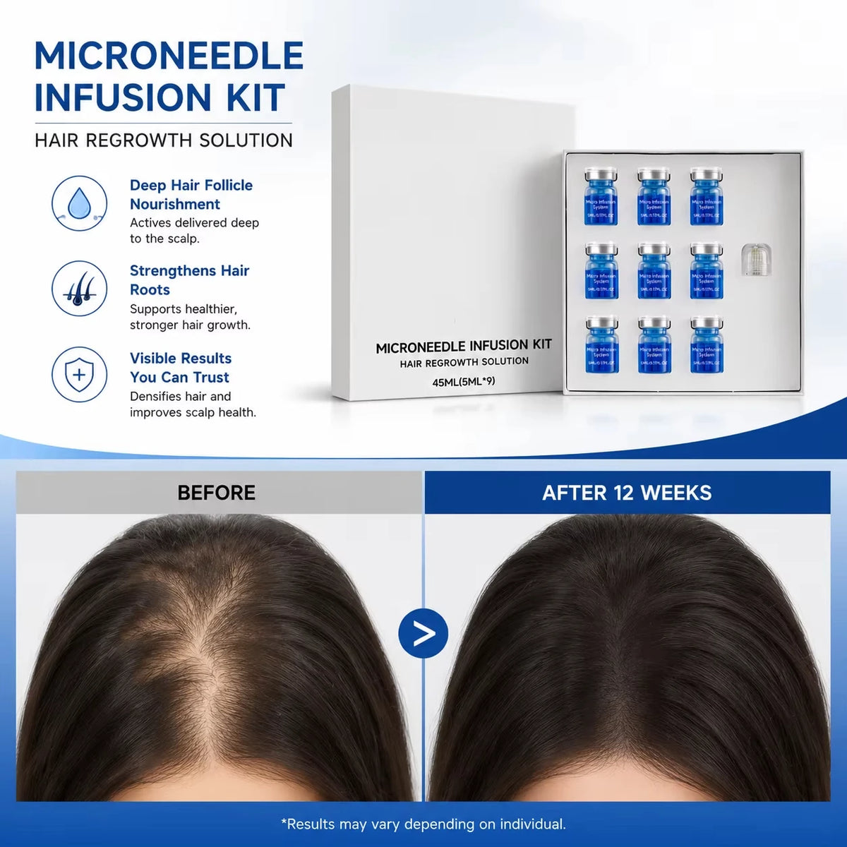 Microcrystal Hair Regrowth Kit Scalp Nourishing Serum for Fuller, Thicker & Healthier Looking Hair