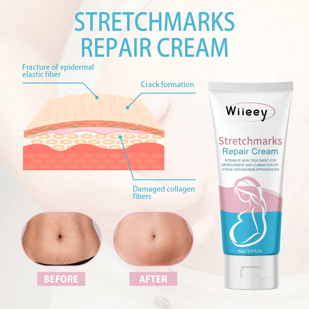 Stretchmarks Repair Cream Remove Pregnancy Firm Skin Enhance Elasticity Body Cream Nourish Moisturizing Pregnant Women Skin Care
