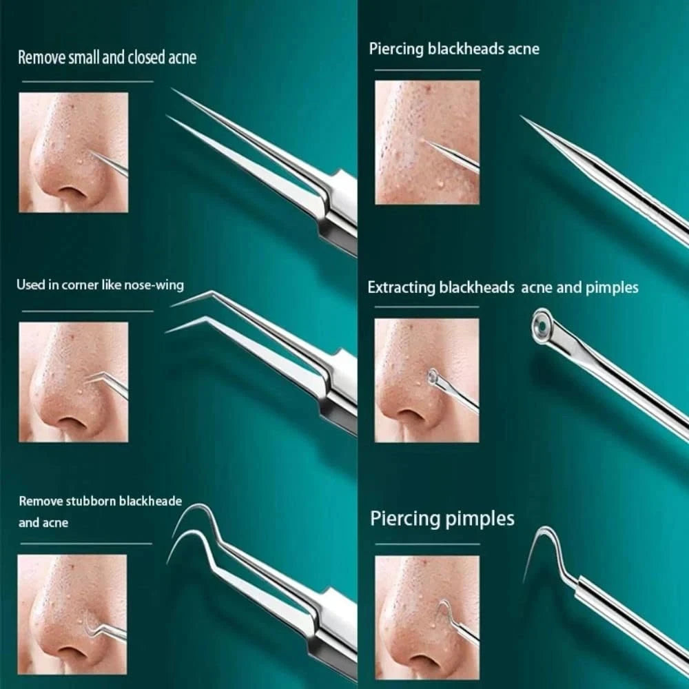 Stainless Steel Tweezers, Facial Blackhead Remover Set - 3-Piece Set With Storage Box, Ultra-Sharp, Cleans Facial Pores