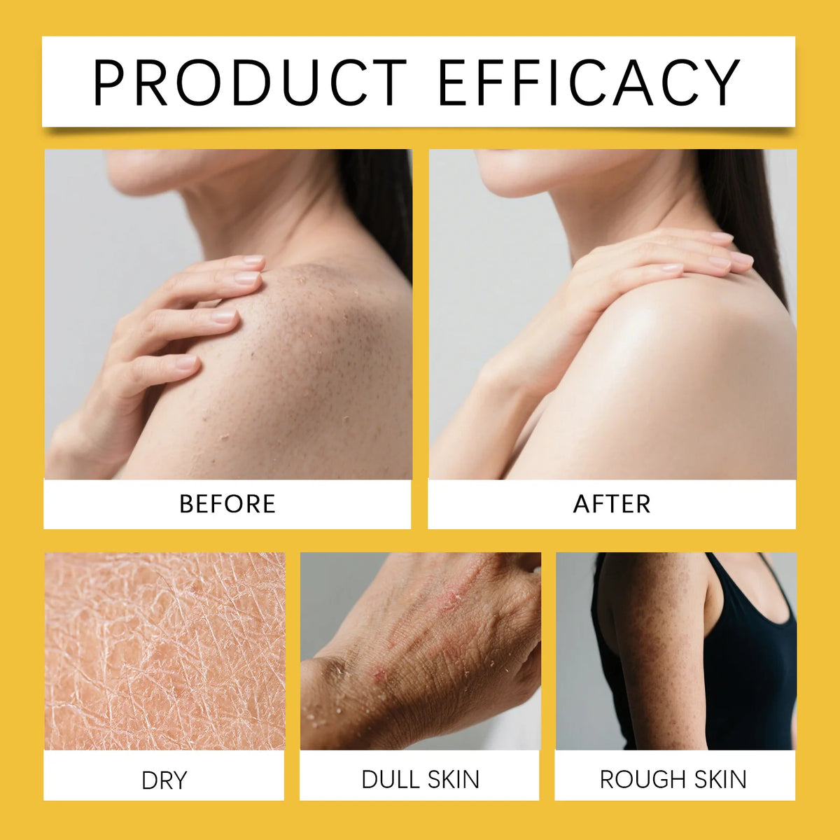 Salicylic Acid Body Wash Cleansing Skin Sweat Eliminating Odor Oil Control Exfoliating Smoothing Softening Foam Shower Gel Slack