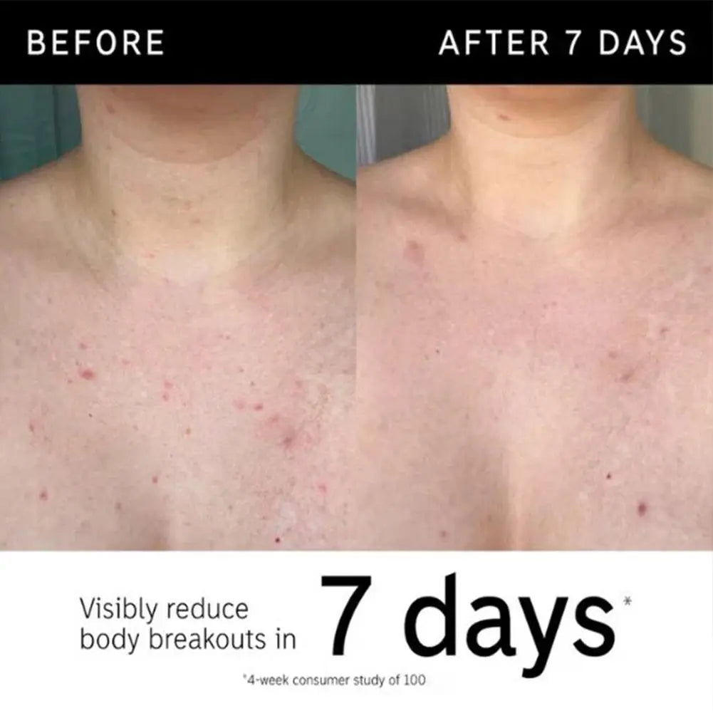 Exfoliating Body Stick Multiple Glycolic Acid Cleaning Long-lasting Moisturizing Nourishing Smoothing Skin Care