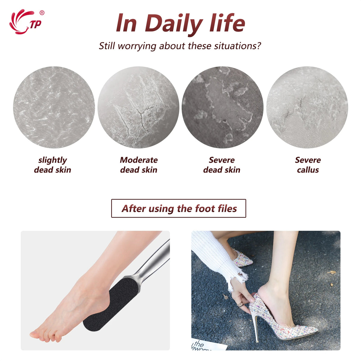 Pedicure Rasp File Callus Remover Foot Files Pedicure Pads Stainless Handle For Foot Care Tools Replaceable Sandpaper