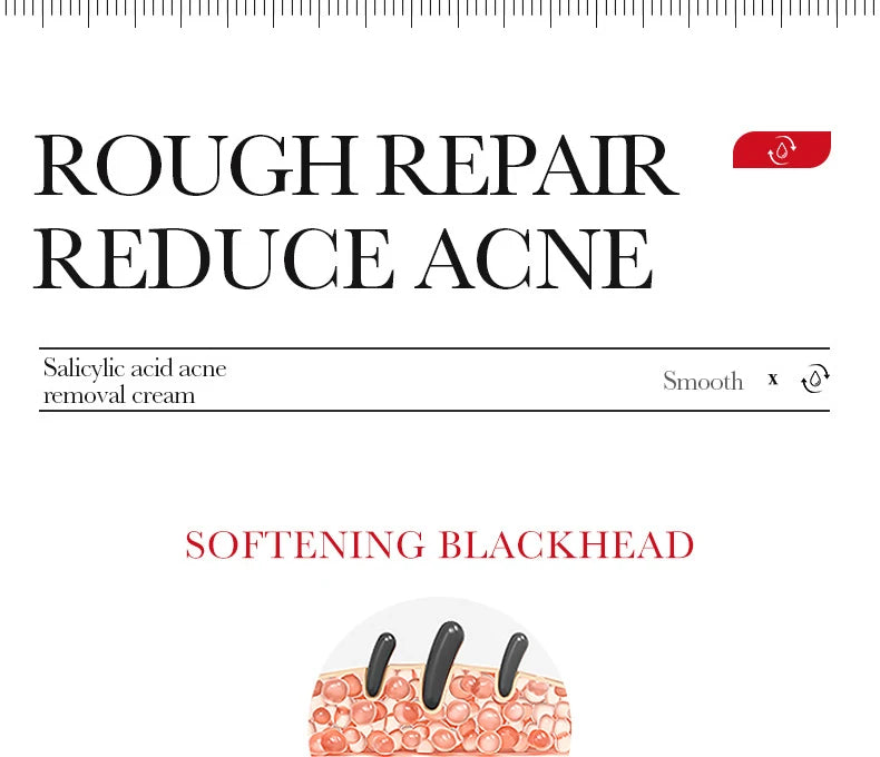 BIOAQUA Salicylic Acid Face Cream Acne Creams Mark Repair Firming Moisturizing Blackhead Remover skincare Facial Cream
