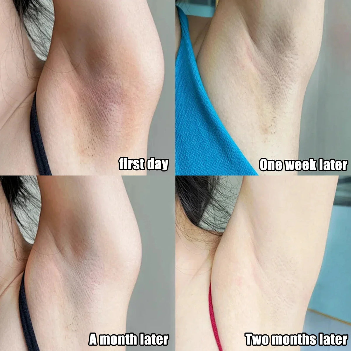 Collagen Underarm Whitening Cream for Dark Skin, Bleaching Underarm Intimate Area Skincare Products
