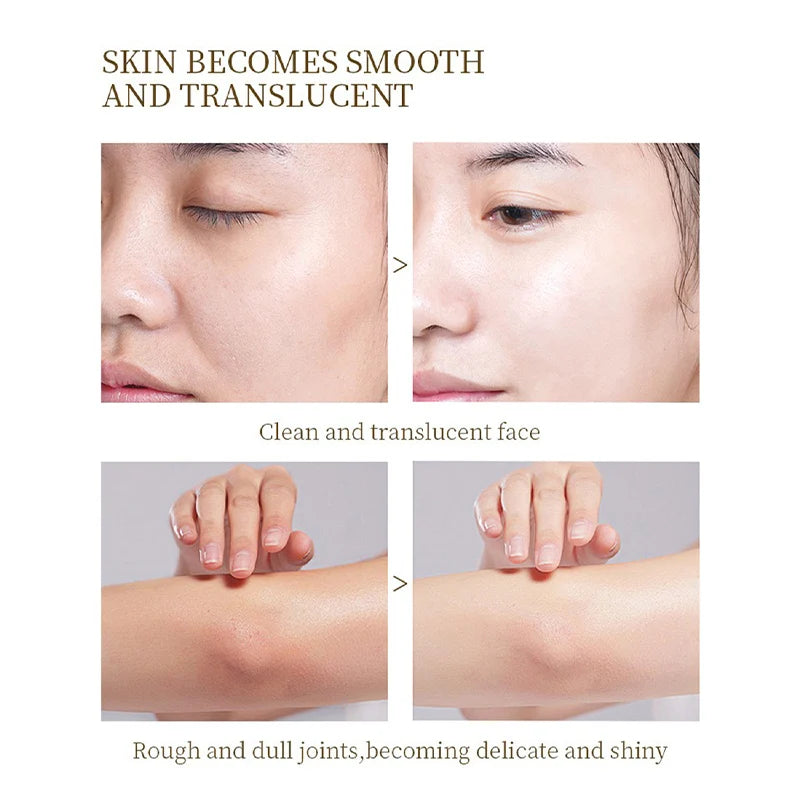 Lf16-35 Orange Exfoliating Gel Gently Cleans Pores Smooth Texture That Reduces Roughness Exfoliates  High Activity Brighten Skin