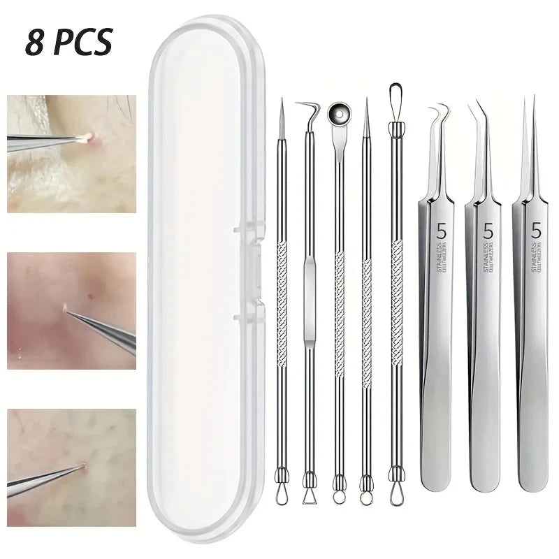 Stainless Steel Blackhead Remover Kit 3 5 8-Piece Professional Pimple Popper Set For Acne Blemish Extraction