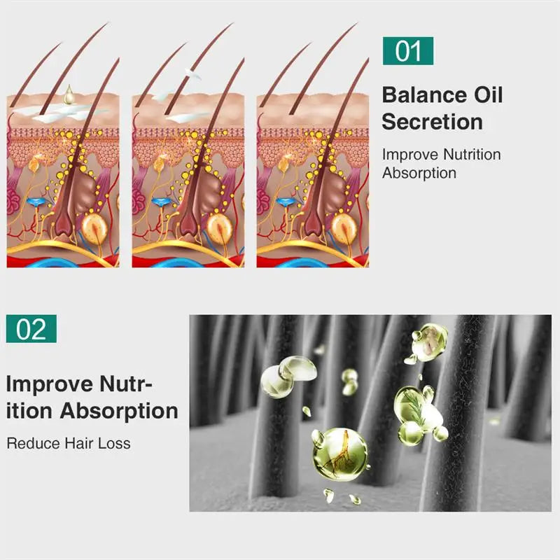 Ginger Hair Growth Essential Oil Natural Anti Hair Loss Products Fast Grow Prevent Baldness Treatment Germinal Liquid Men Women