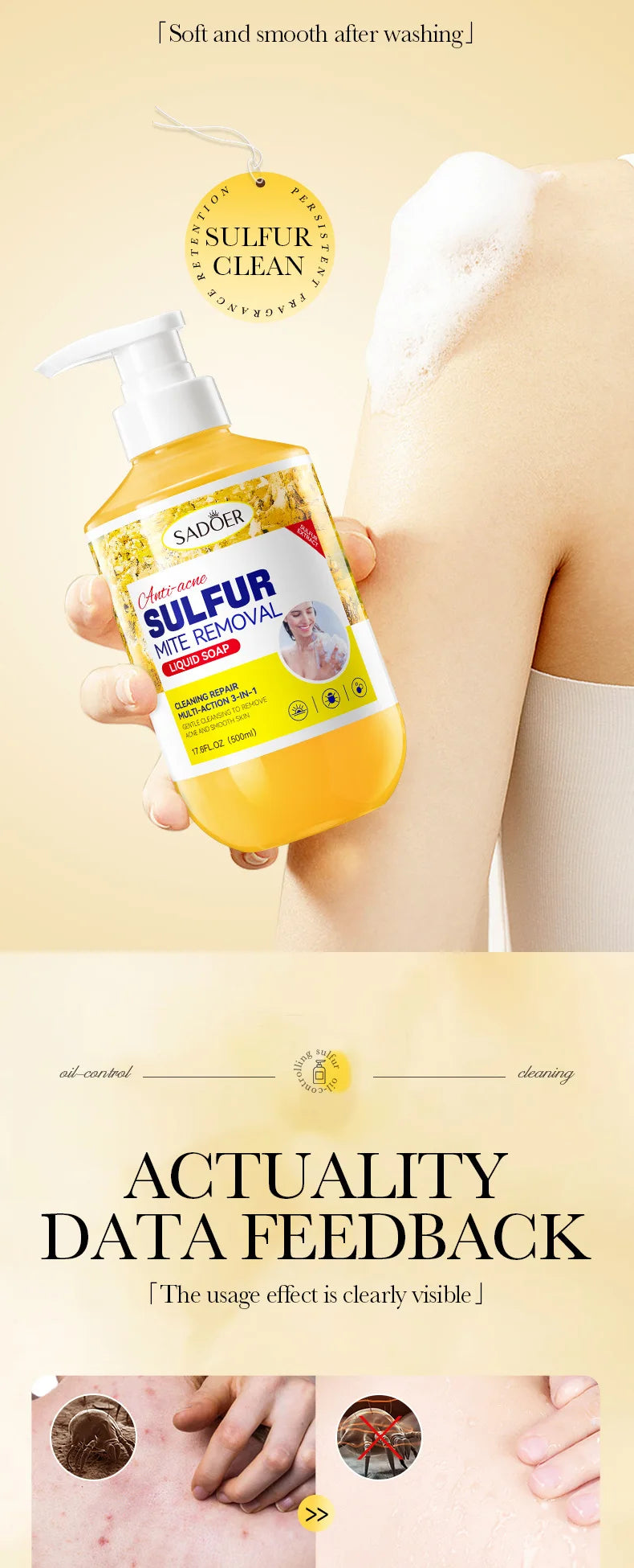 500m Anti-Mite Sulfur Shower Gel Deep Cleansing Oil Control Anti-Acne Soothe Repair Body Skin Care Wash for Women & Men