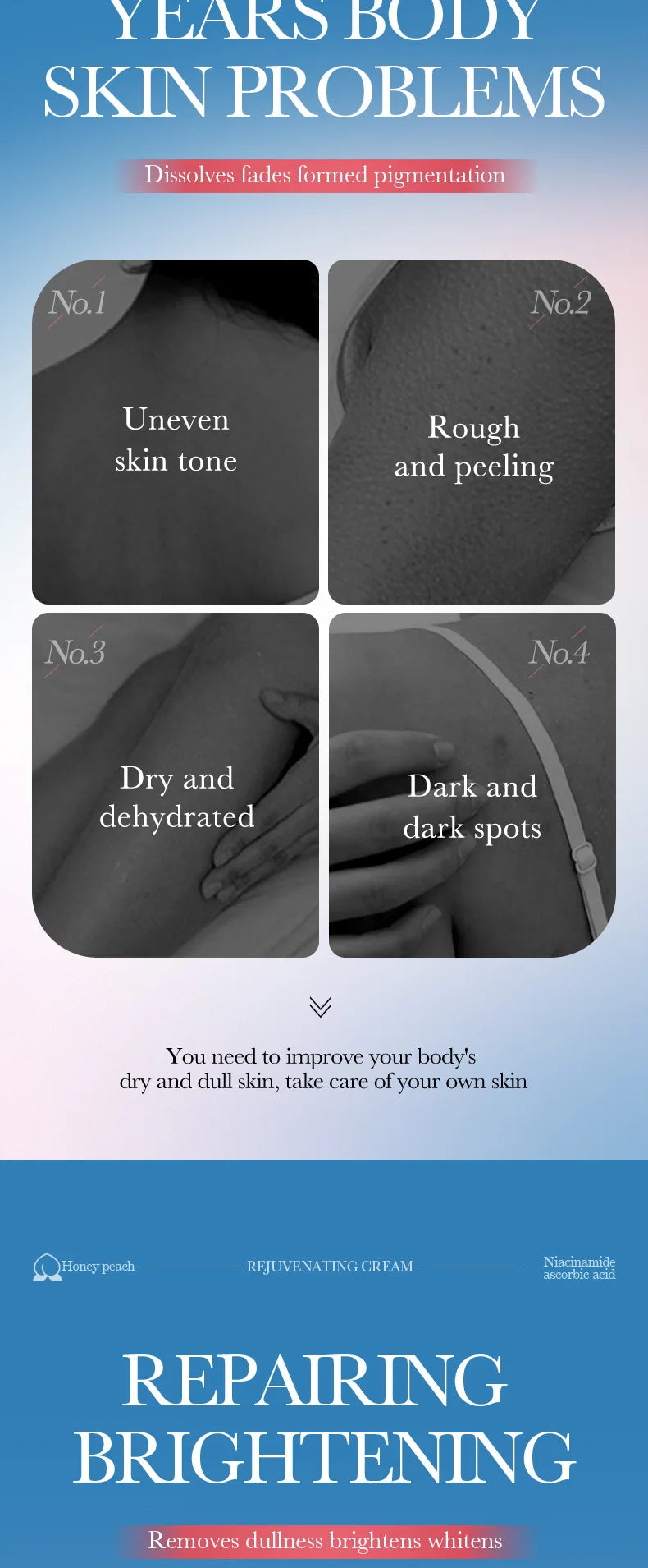 Whitening Body Cream For Dark Skin Armpit Thigh Inner Joint Fade Intimate Area Underarm Body Care Private Part Brighten Lotion