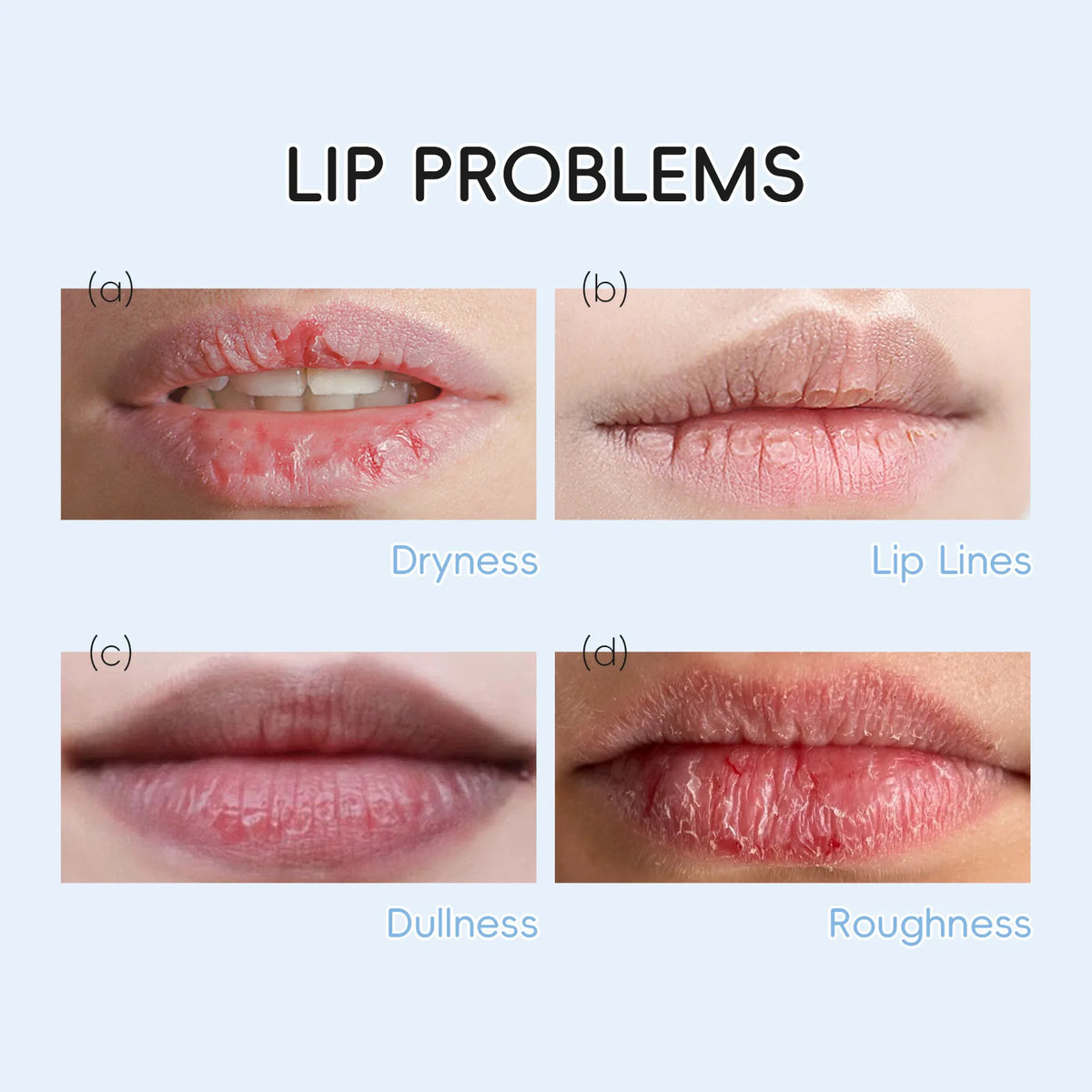 LAIKOU 5/10pcs Lip Mask Lip Care Moisturizing Hydrating Repair Lighten Lip Lines  Gel Patch Lips Pad Patches Care Products