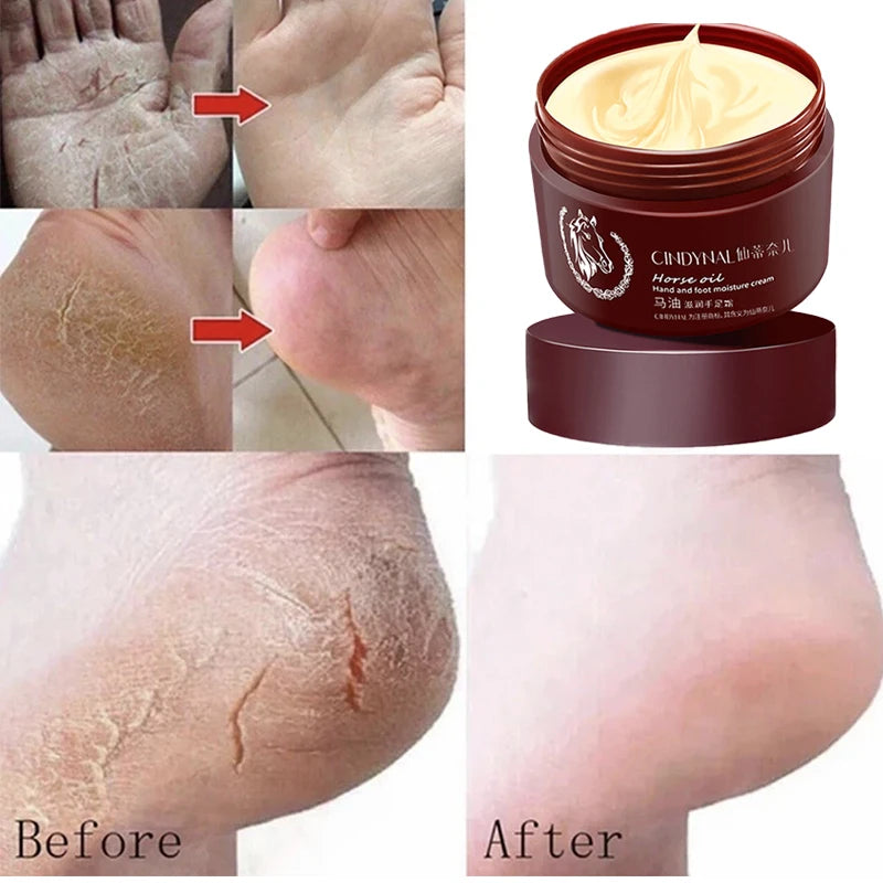 Horse Oil Skin Restoration Cream,110g Repair Hand Cream, Moisturizing Foot Cream,Foot Repair Cream,Anti Foot Cream for Women Men