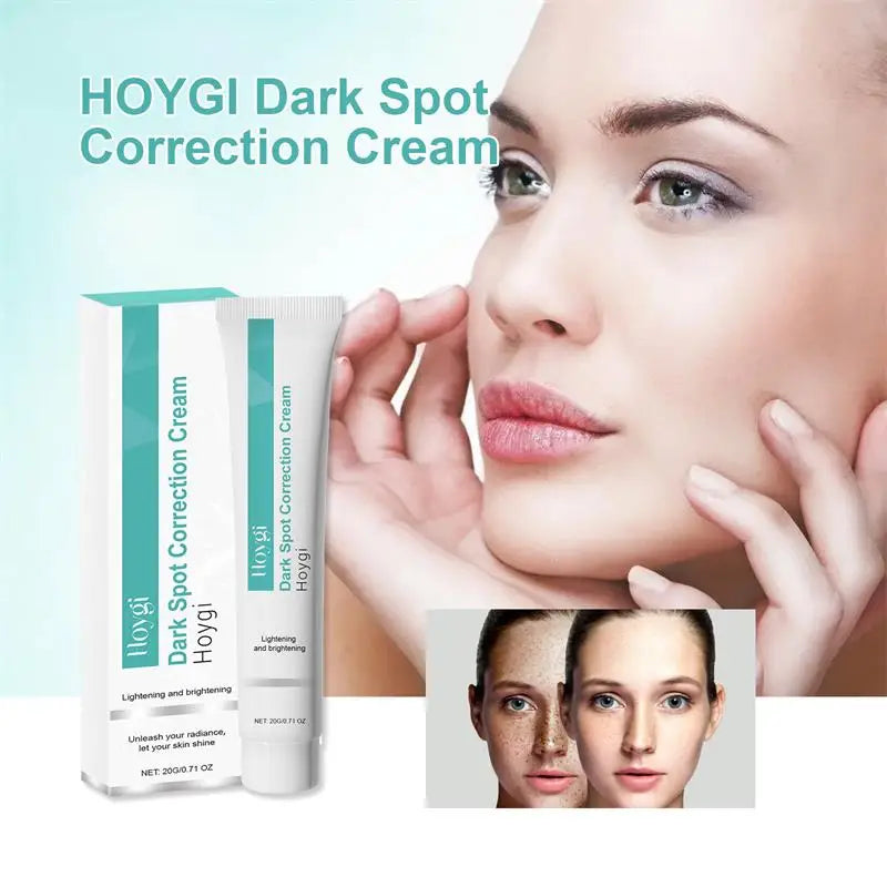 Powerful Spot-removing Whiten Cream Brighten Skin Fast Eliminates Melanin Pigmentation Melasma Dark Spots Moisturize Beauty Gel