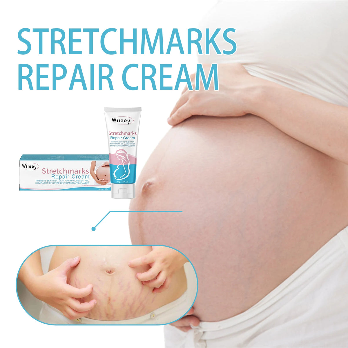 Stretchmarks Repair Cream Remove Pregnancy Firm Skin Enhance Elasticity Body Cream Nourish Moisturizing Pregnant Women Skin Care