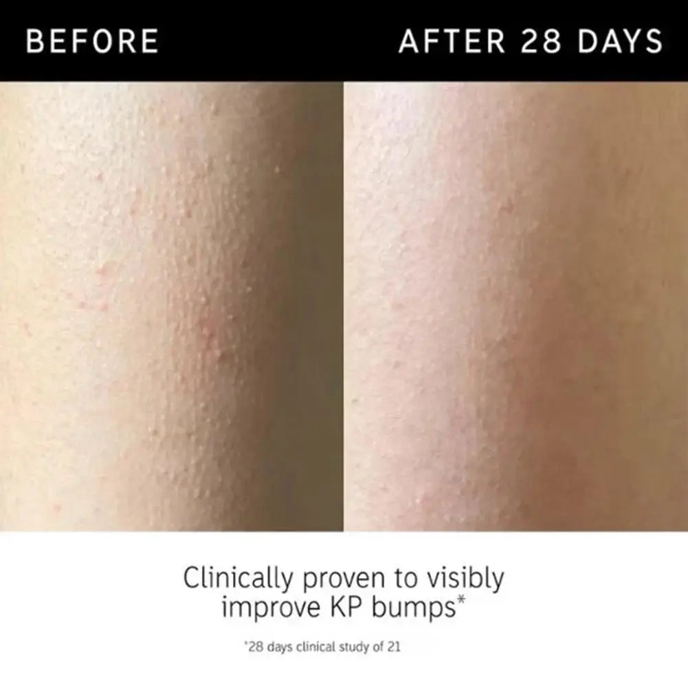 Exfoliating Body Stick Multiple Glycolic Acid Cleaning Long-lasting Moisturizing Nourishing Smoothing Skin Care