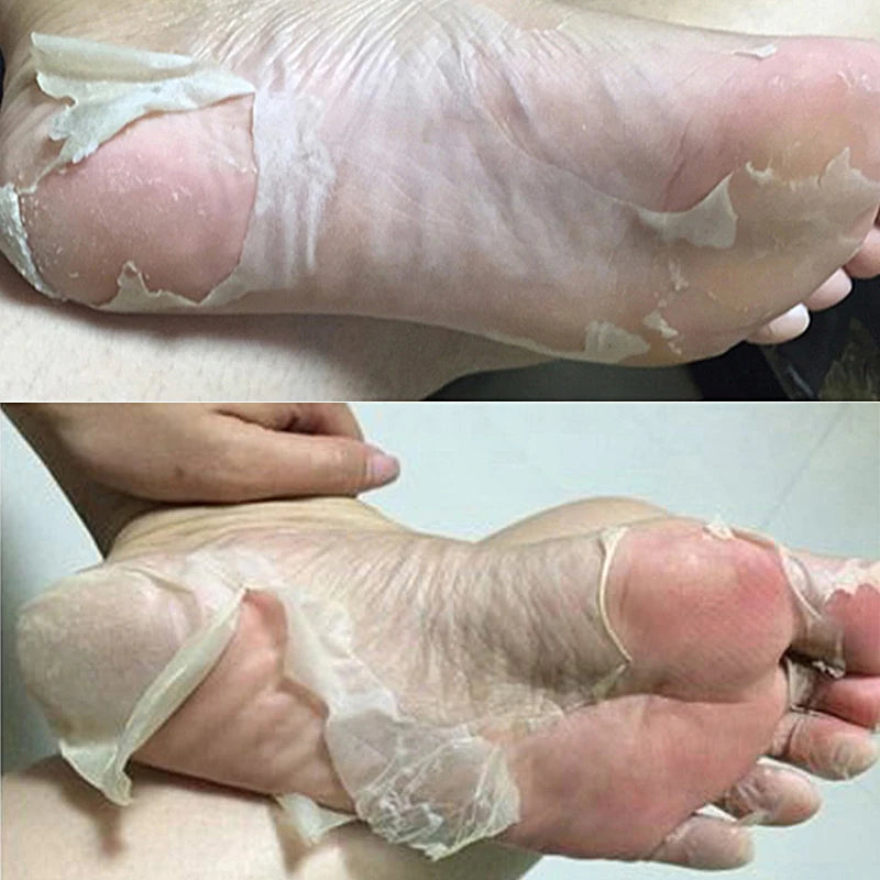 Lavender & VC Foot Peeling Mask Exfoliating Heels Calluses Remove Foot Patches Dead Skin Remover Pedicure Socks Foot Care 1Pair