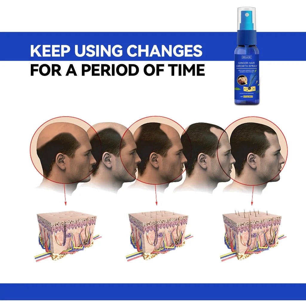 Ginger Hair Growth spray Anti Hair Fall Hair Loss Treatment Growth Essence Oil for Men Women