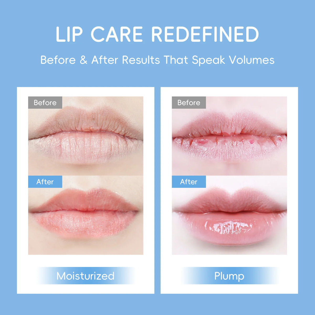 LAIKOU 5/10pcs Lip Mask Lip Care Moisturizing Hydrating Repair Lighten Lip Lines  Gel Patch Lips Pad Patches Care Products