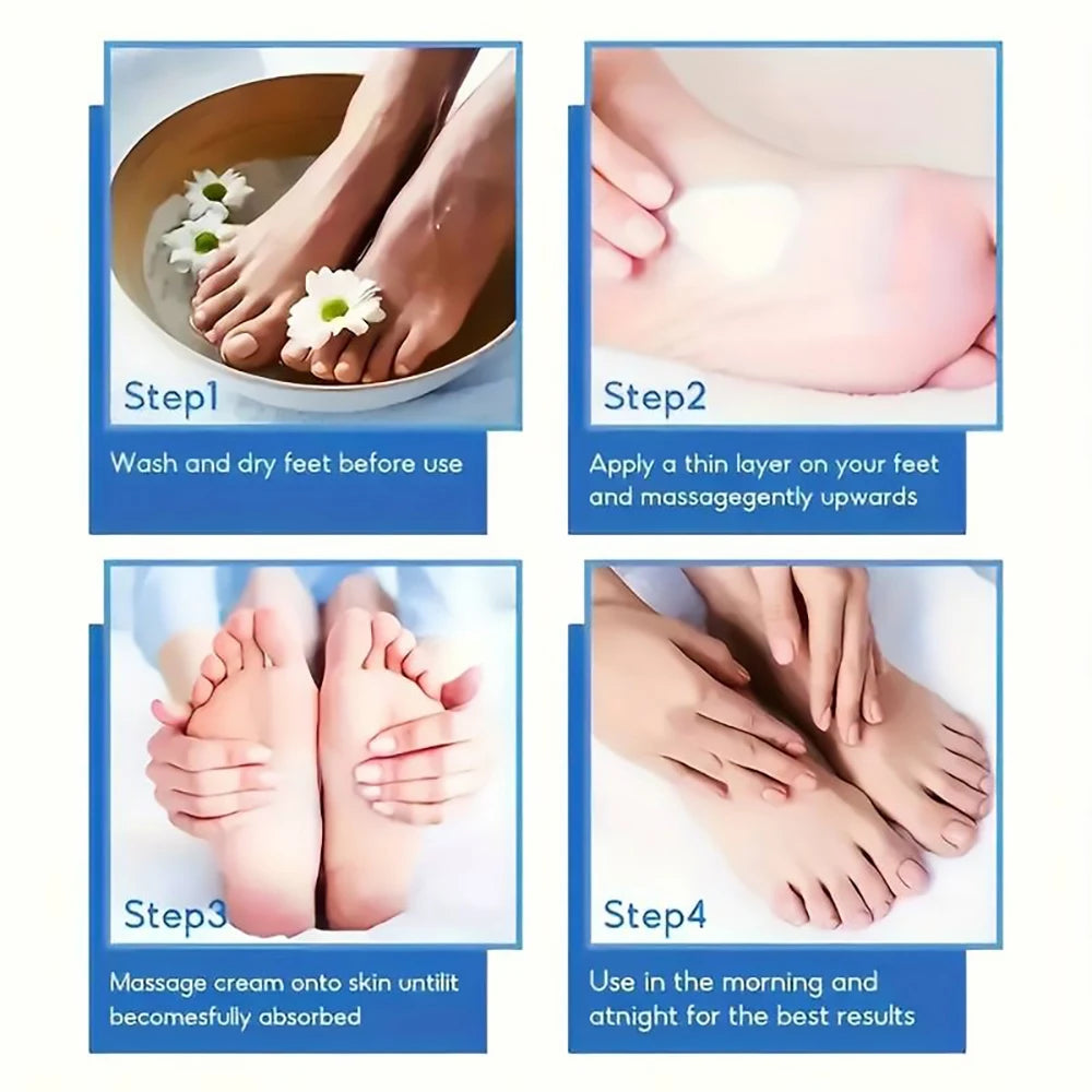 SUYARUN 60% Urea Foot Cream for Cracked Heels & Dry Skin - Intensive Moisturizing Treatment, Callus Remover, Diabetic Foot Care.