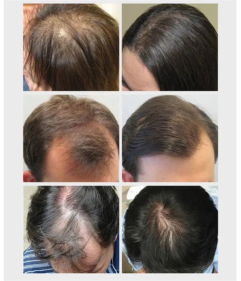 Ginger Hair Growth Essential Oil Natural Anti Hair Loss Products Fast Grow Prevent Baldness Treatment Germinal Liquid Men Women