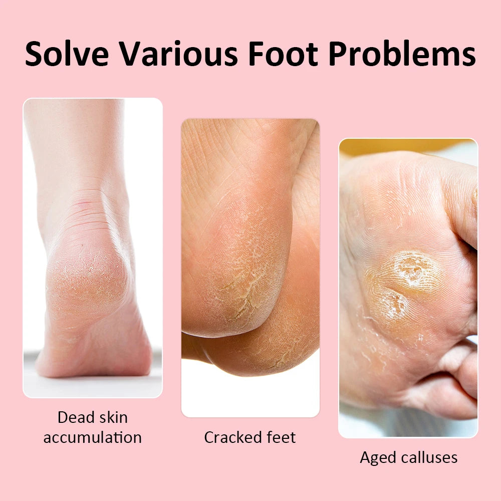 USB Rechargeable Wireless Electric Foot File Cuticle Callus Remover Machine Pedicure Tools Foot Heel Care Tool With Sandpaper