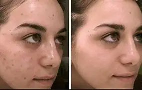 Retinol Whitening And Spot Removing Cream Softens Fine Lines & Wrinkles Repairs Skin Barriers Moisturizing And Brightening Face
