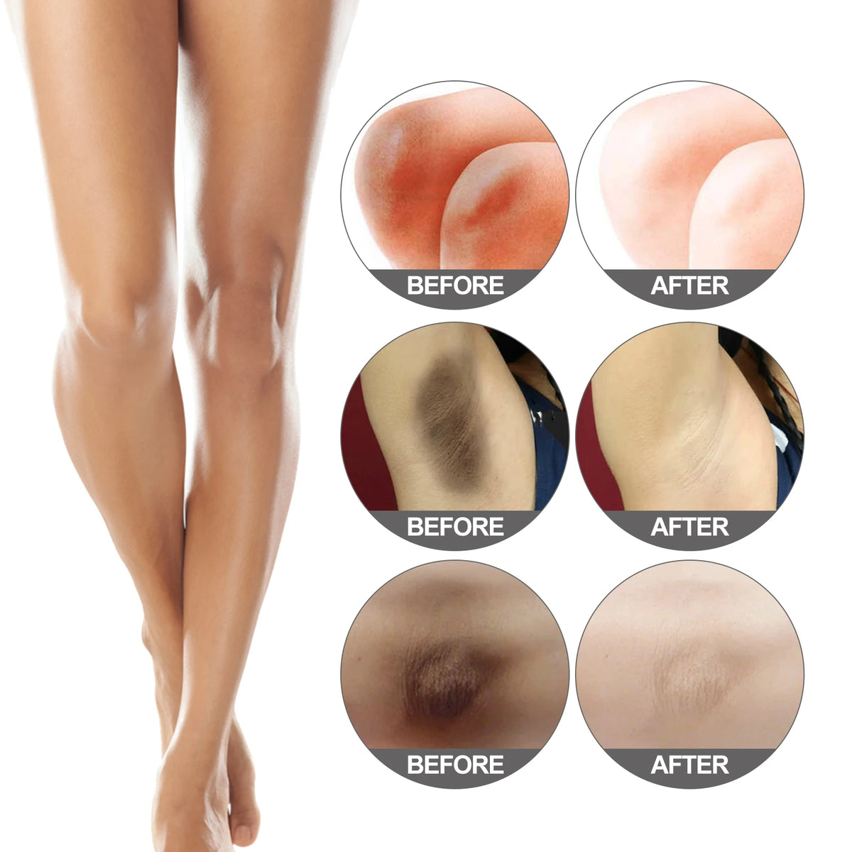 Body Snow Bleach Cream Dark Spot Corrector Niacinamide Brightening Body Cream for Underarms Inner Thighs Knees Elbows Bikini Are
