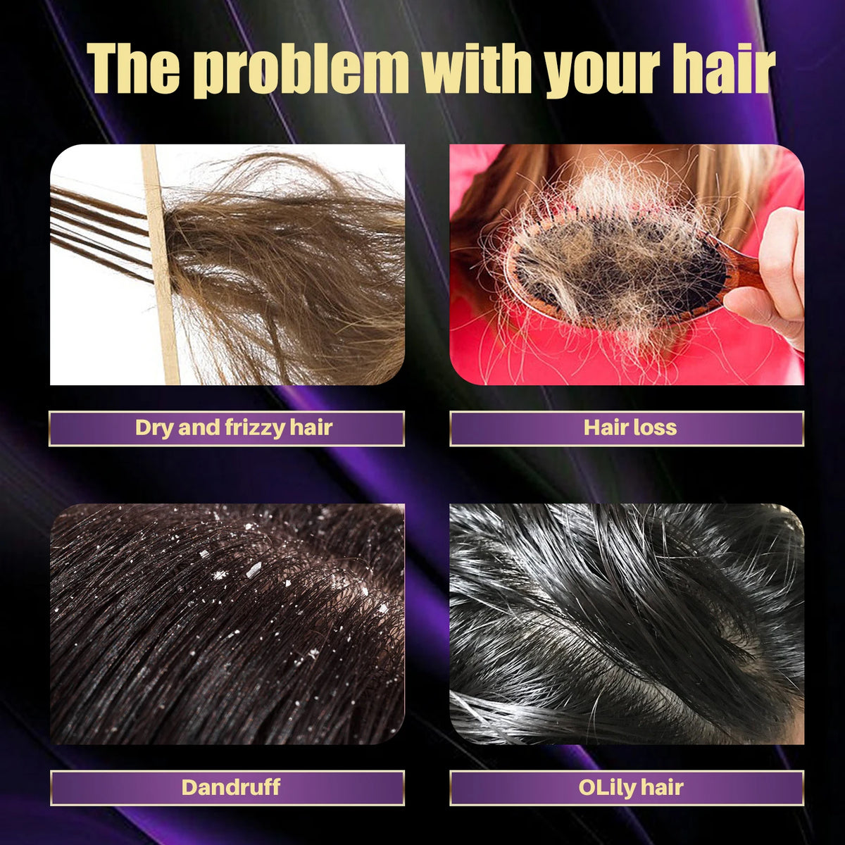 100ML Hair Shampoo For Fast Hair Growth Rosemary Onion Shampoo 30ML Spray Anti Hair Loss Effective Within 7 Day Hair Growth