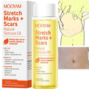 150ml Vitamin E Skin Care Oil Remove Pregnancy Stretch Marks Postpartum Care Elastic Skin Firming Collagen Body Care Oil