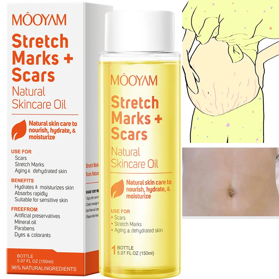 150ml Vitamin E Skin Care Oil Remove Pregnancy Stretch Marks Postpartum Care Elastic Skin Firming Collagen Body Care Oil