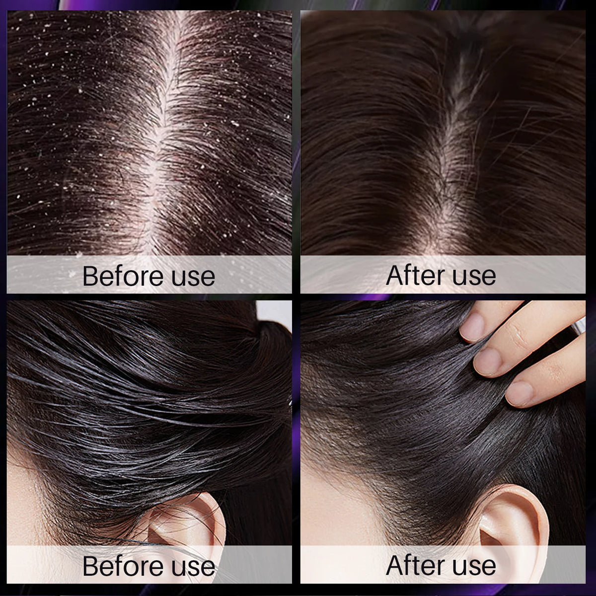 100ML Hair Shampoo For Fast Hair Growth Rosemary Onion Shampoo 30ML Spray Anti Hair Loss Effective Within 7 Day Hair Growth