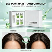Gentle Hair Care Serum For Home Microneedling Use Constantly Nourish Scalp To Alleviate Dry And Frizzy Hair Status