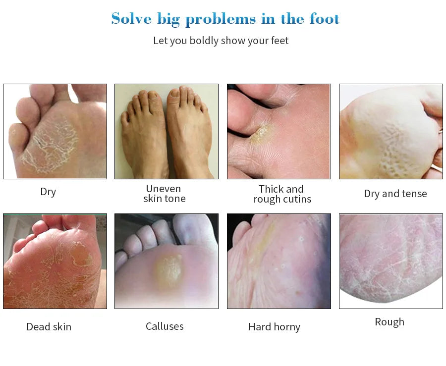 1 Pag = 1 Pair Honey Foot Mask For Remove Dead Skin Calluses Exfoliating Foot Mask Feet Cream Whitening Foot Spa Skin Care Tool