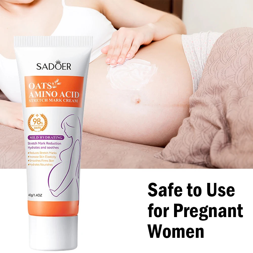 40g Removes Stretch Mark Cream To Remove Postpartum Obesity Pregnant Women Repair Anti-Aging Winkles Firming Body Cream SkinCare