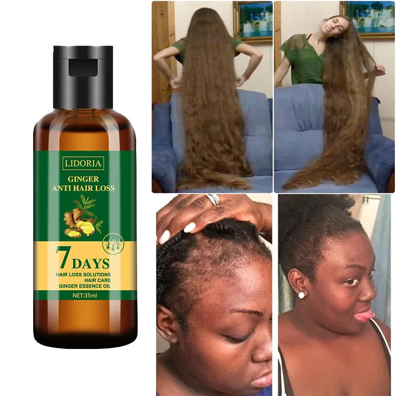 Ginger Hair Growth Essential Oil Natural Anti Hair Loss Products Fast Grow Prevent Baldness Treatment Germinal Liquid Men Women