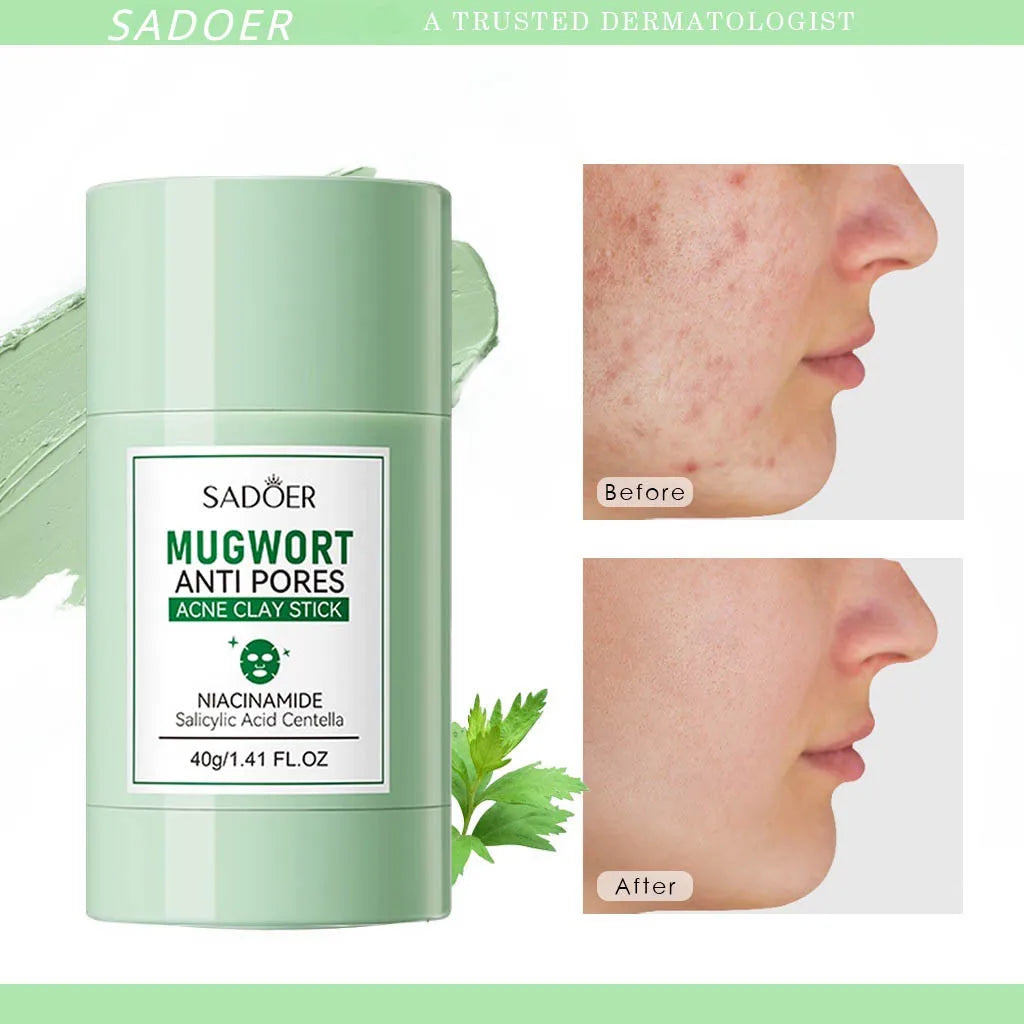 Mugwort Clay Stick Anti-Acne Clay Mask for Clean Pores and Blackheads Improve Acne Prone Skin 40g