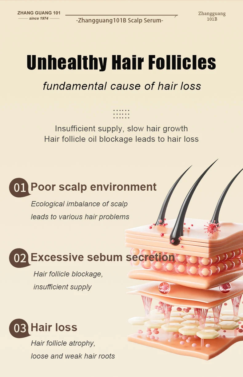 Hair Tonic Zhangguang 101B 101M 120ML Powerful Chinese Medicine Therapy Anti Hair Loss Treatment Essence 100% Original