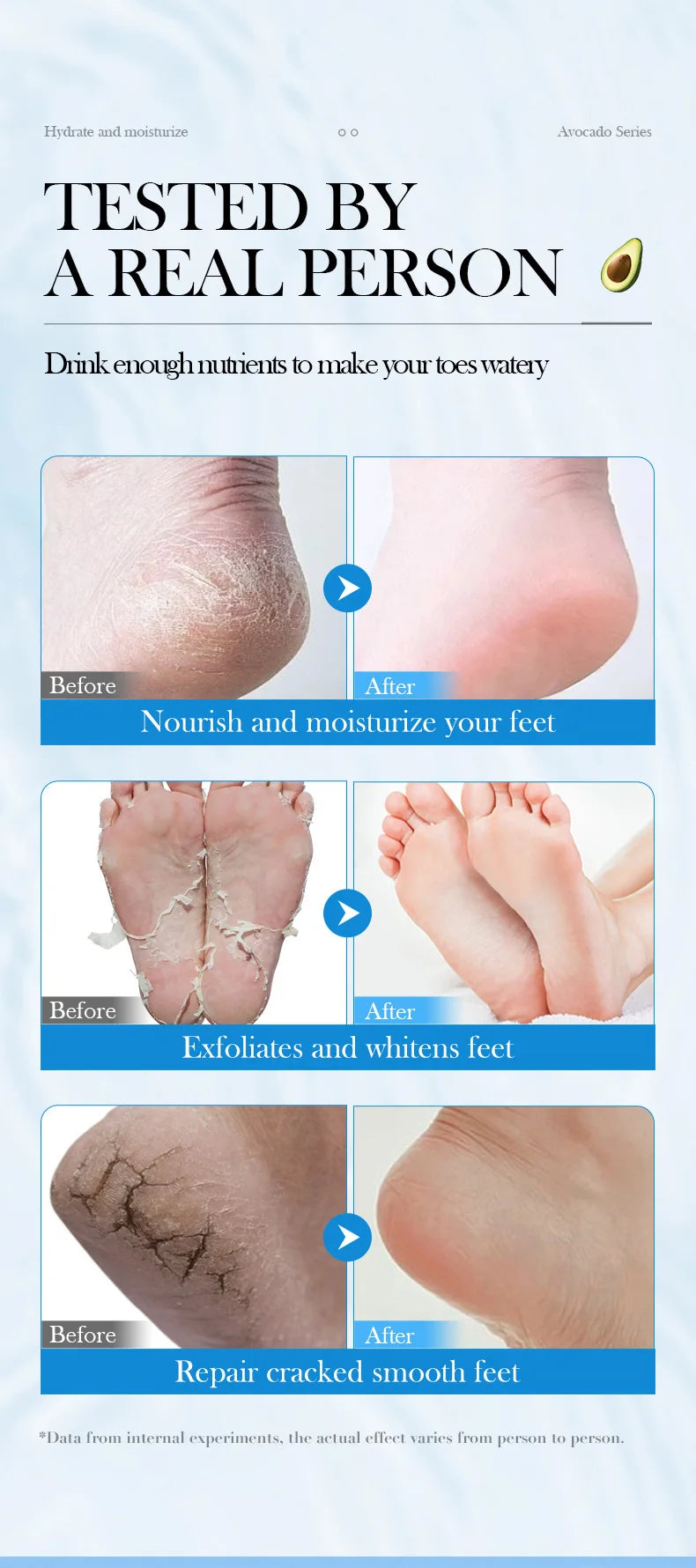 5 Pairs Avocado Exfoliating Foot Mask Feet Pedicure Remove Dead Skin Moisturizing Foot Exfoliator Feet Masks Skin Care Products