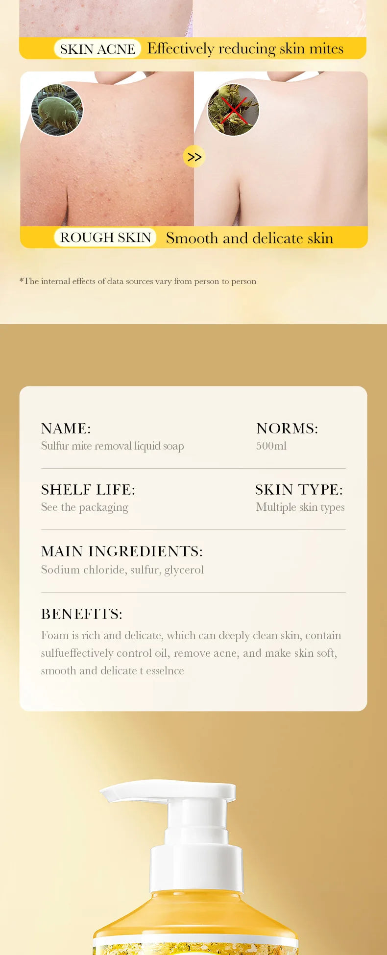 500m Anti-Mite Sulfur Shower Gel Deep Cleansing Oil Control Anti-Acne Soothe Repair Body Skin Care Wash for Women & Men