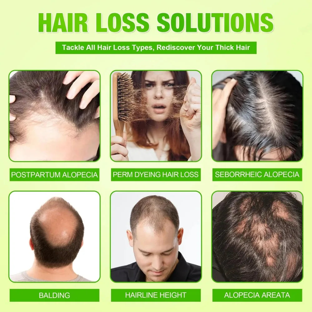 Nourishing Scalp Hair Serum Microneedle Roller Kit Reduce Hair Loss Strengthen Hair Roots Daily Care.