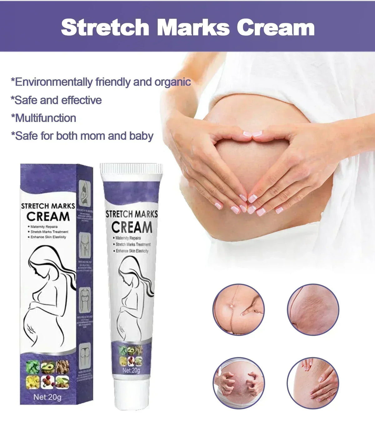 Stretch Mark Vanishing Cream Effective treatment Remove Body Buttock Breast Marks Repair Maternity Loose Firming Skin body Care