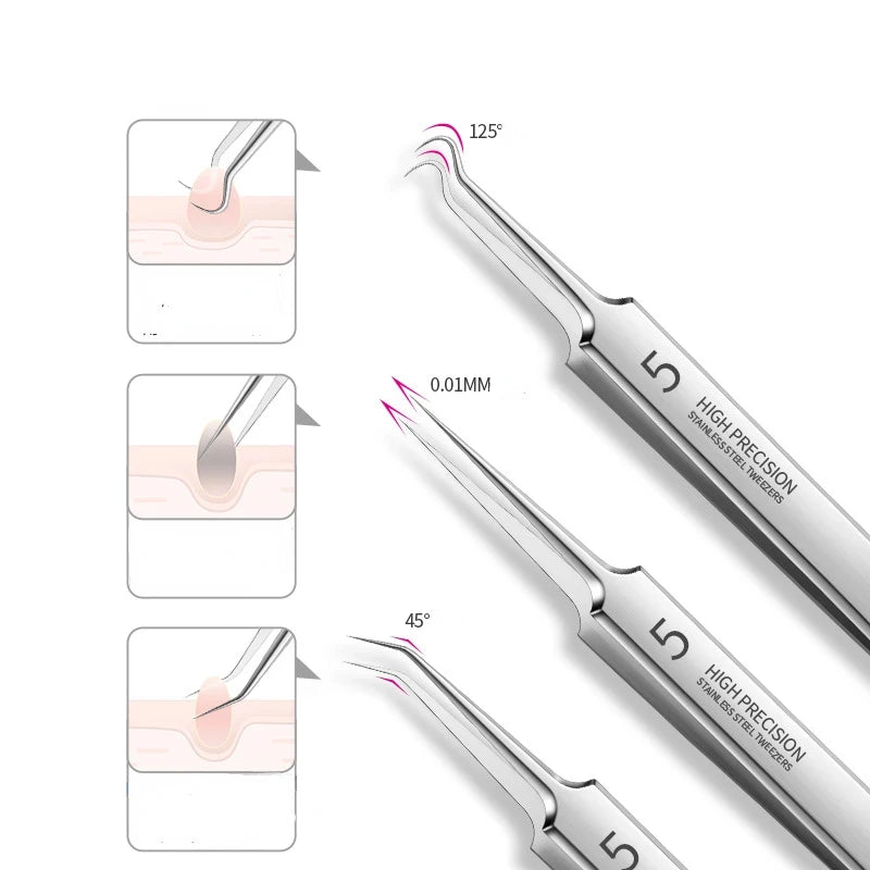 Stainless Steel Tweezers, Facial Blackhead Remover Set - 3-Piece Set With Storage Box, Ultra-Sharp, Cleans Facial Pores