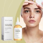West&Month Glycolic Toner Remove Acne Marks Lightening Repairing Exfoliating Hydrating Whitening Rejuvenating Skin Care Products