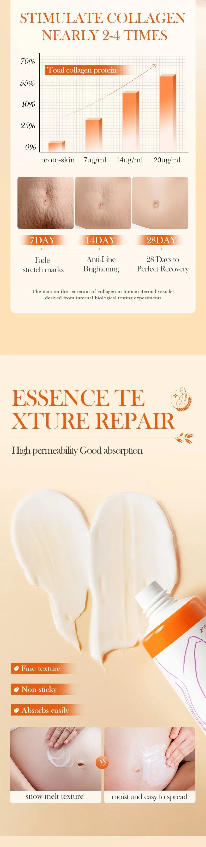 40g Removes Stretch Mark Cream To Remove Postpartum Obesity Pregnant Women Repair Anti-Aging Winkles Firming Body Cream SkinCare