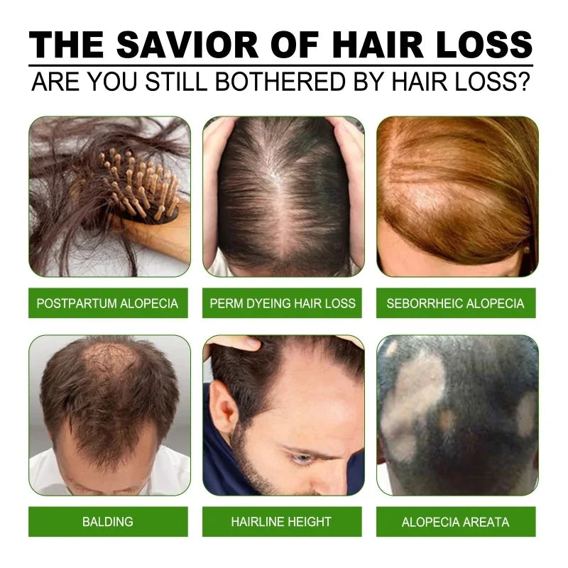Fast Ginger Hair Growth Cream Anti Hair Loss Baldness Repair Damaged Scalp Treatment Nourish Hair Root Care Products Women Men